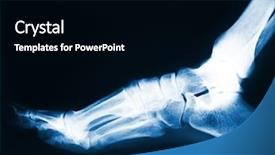  Presentation with human foot - Beautiful PPT theme featuring x-ray image of human backdrop and a black colored foreground