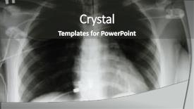  Presentation with chest x ray human - Slides with x-ray of a chest background and a dark gray colored foreground
