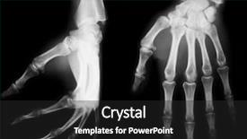  Presentation with anatomy - Theme featuring x-ray of both human background and a dark gray colored foreground