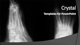  Presentation with human anatomy - Slides with x-ray of both human background and a black colored foreground