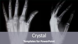  Presentation with human foot - Beautiful theme featuring x-ray of both human backdrop and a gray colored foreground