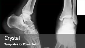  Presentation with human foot - Amazing PPT layouts having x-ray of both human backdrop and a dark gray colored foreground