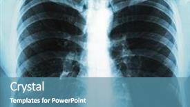  Presentation with chest - Audience pleasing presentation theme consisting of x-ray of human chest backdrop and a teal colored foreground