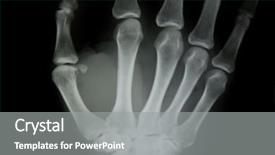  Presentation with human foot - Colorful PPT theme enhanced with x-ray of human hand backdrop and a gray colored foreground