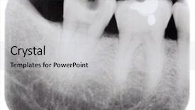  Presentation with decay - PPT theme consisting of x ray of molars background and a light gray colored foreground