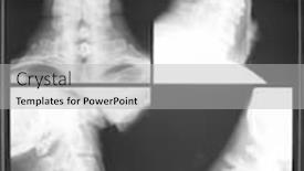  Presentation with cervical - Cool new PPT layouts with x-ray of the cervical backdrop and a light gray colored foreground