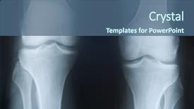  Presentation with photograph - Presentation theme having x-ray photograph of two background and a ocean colored foreground