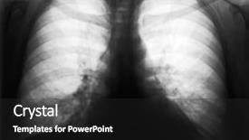  Presentation with negative - Beautiful presentation design featuring x-ray picture of human backdrop and a dark gray colored foreground