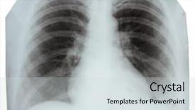  Presentation with normal - Colorful presentation theme enhanced with x-ray picture showing backdrop and a light gray colored foreground