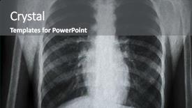  Presentation with human body - Theme consisting of x-ray picture background and a gray colored foreground