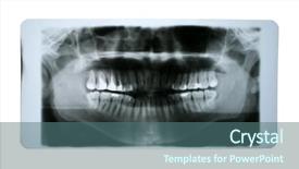  Presentation with human mouth - Audience pleasing PPT theme consisting of champagne bottle decorated with christmas ornaments and matching ribbons backdrop and a mint green colored foreground