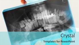  Presentation with xray - Slide deck consisting of x ray teeth - female doctor with jaw xray background and a arctic colored foreground