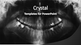  Presentation with panoramic - Slides featuring x-ray teeth panoramic image background and a black colored foreground