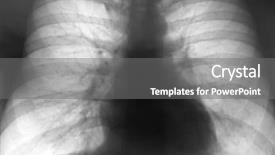  Presentation with xray - Beautiful PPT layouts featuring xray of the chest backdrop and a gray colored foreground