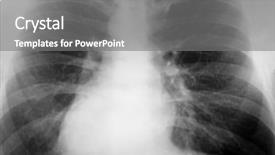  Presentation with xray - Slides having xray of the chest background and a gray colored foreground