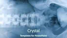  Presentation with xray - PPT theme with kyphosis - xray spine human background and a ocean colored foreground