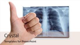  Presentation with lung - Presentation theme enhanced with thoracic - male hand showing thumbs up background and a coral colored foreground
