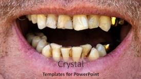  Presentation with teeth - Audience pleasing presentation design consisting of yellow-crooked-teeth backdrop and a coral colored foreground