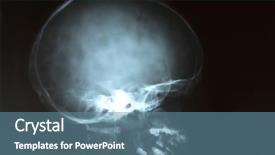  Presentation with film black and white - Colorful presentation theme enhanced with young boy head on black backdrop and a teal colored foreground