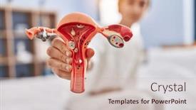  Presentation with uterus - Theme consisting of young-caucasian-woman-suffering background and a  colored foreground