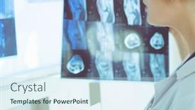  Presentation with lungs - Audience pleasing slide set consisting of young-female-doctor-looking backdrop and a sky blue colored foreground