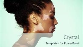  Presentation with vitiligo - Colorful presentation design enhanced with young-fresh-beautiful-woman backdrop and a cool aqua colored foreground