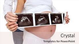  Presentation with medical ultrasound - Amazing theme having young pregnant couple expecting backdrop and a soft green colored foreground