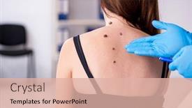  Presentation with doctor visiting family - PPT theme consisting of young-woman-visiting-male-doctor background and a lemonade colored foreground