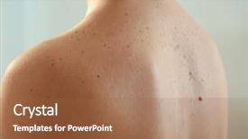  Presentation with melanoma - Slide deck having melanoma - young woman with problem skin background and a red colored foreground