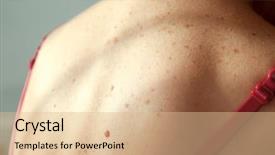  Presentation with skin cancer malignant melanoma - Amazing presentation having young woman with problem skin backdrop and a  colored foreground