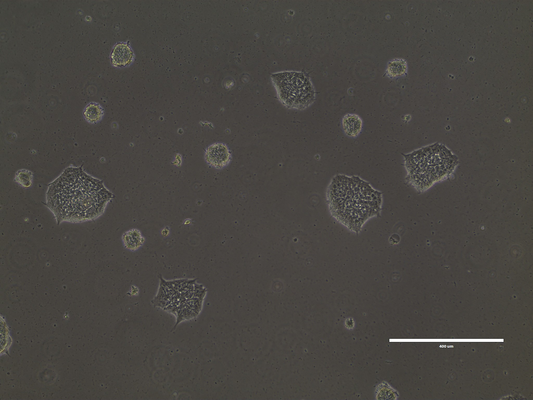 Thawing of human pluripotent stem cells