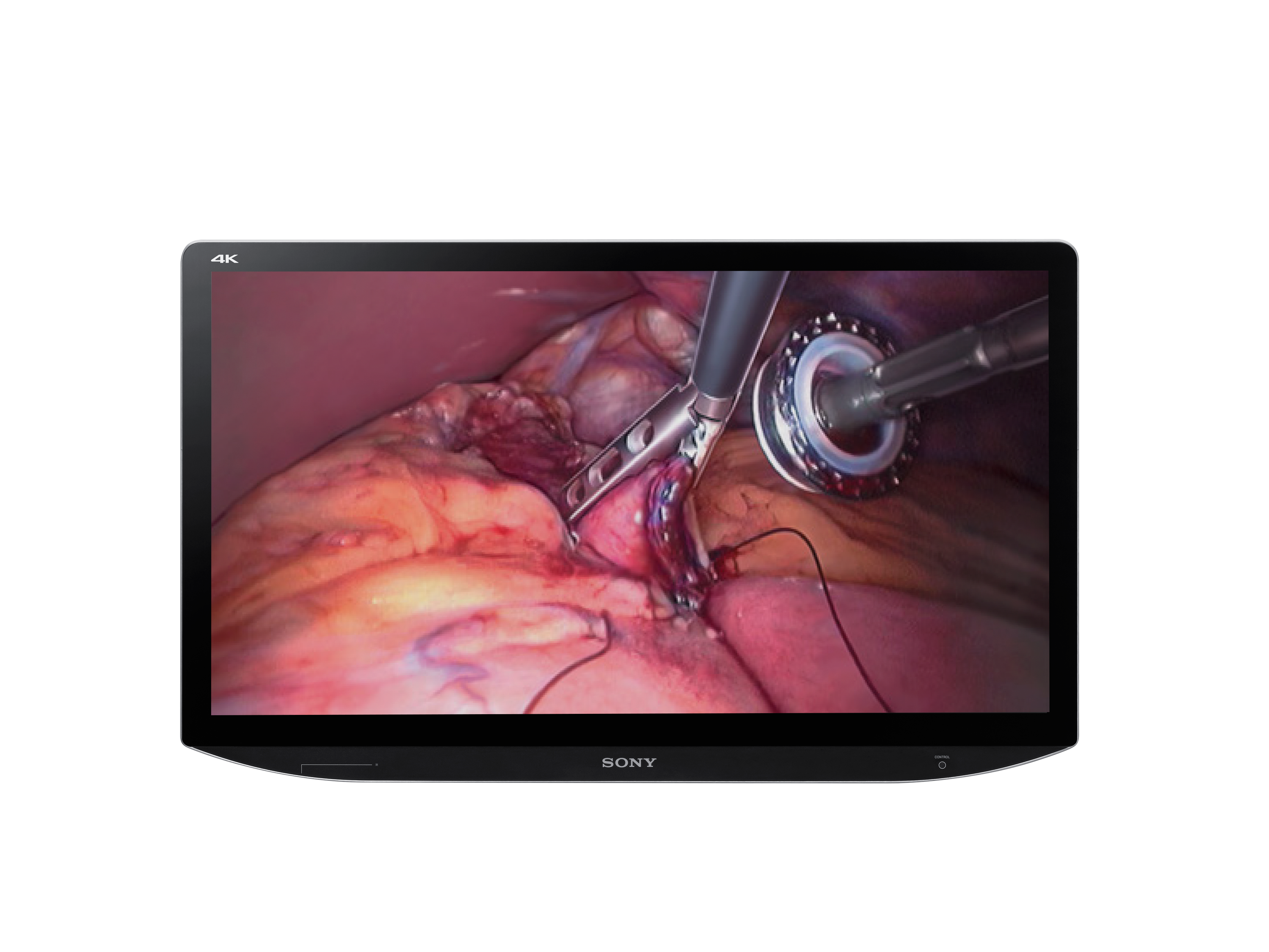 Sony Transforms Robotic Surgery with 4K 3D Technology at AUA