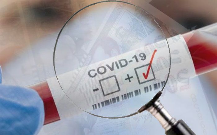 Fondos del covid-19
