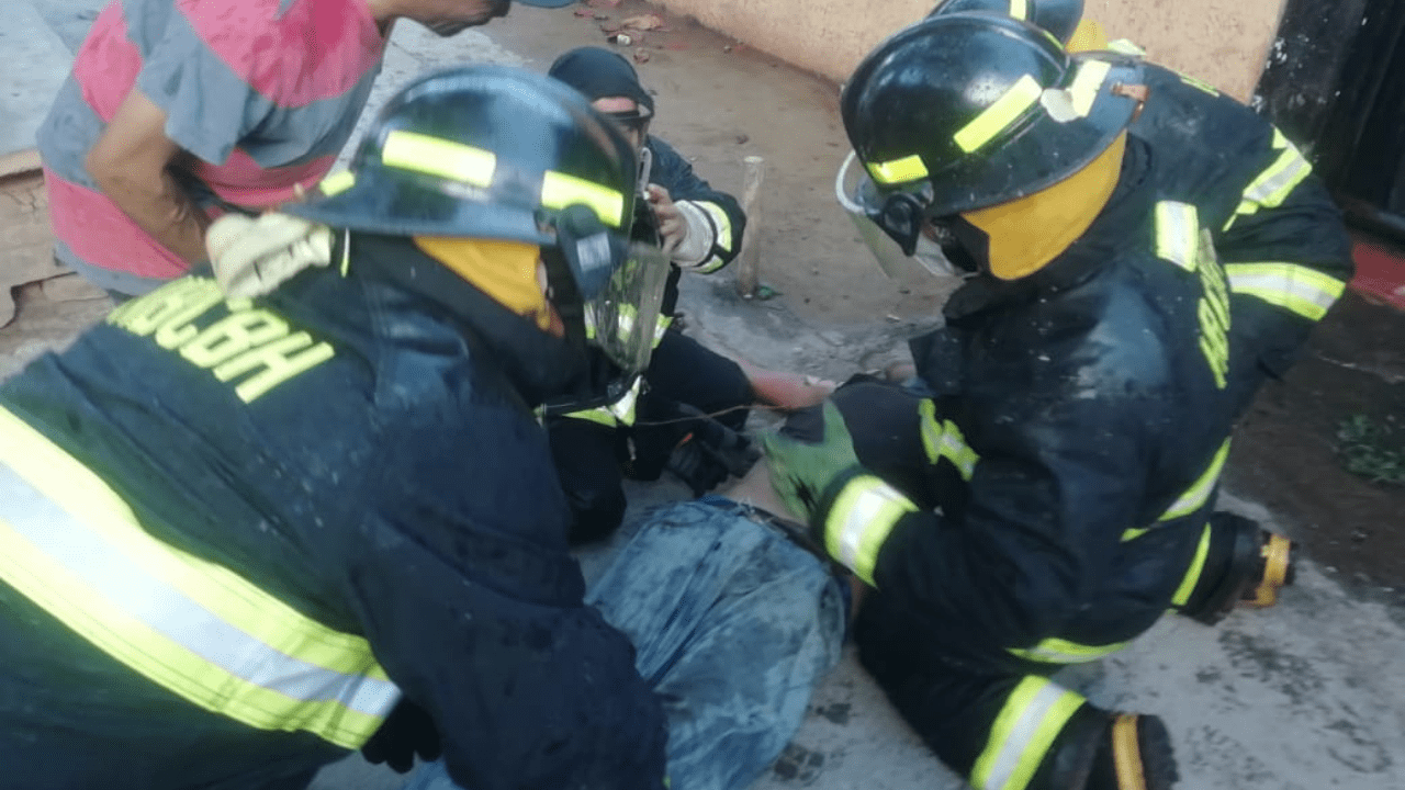 Hombre resulta con quemaduras tras incendio en una casa de la populosa ...