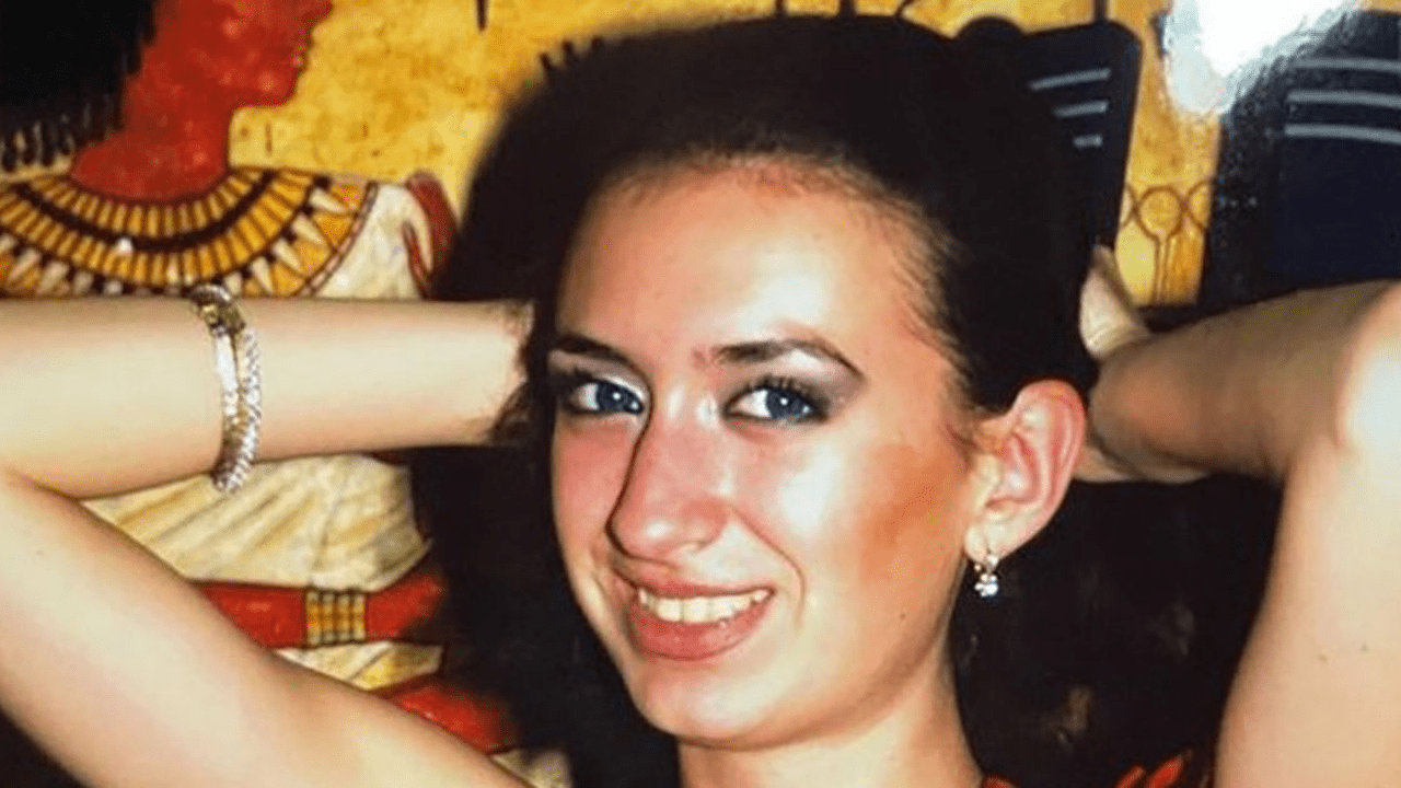 El impactante antes y después de la mujer con los pómulos más grandes