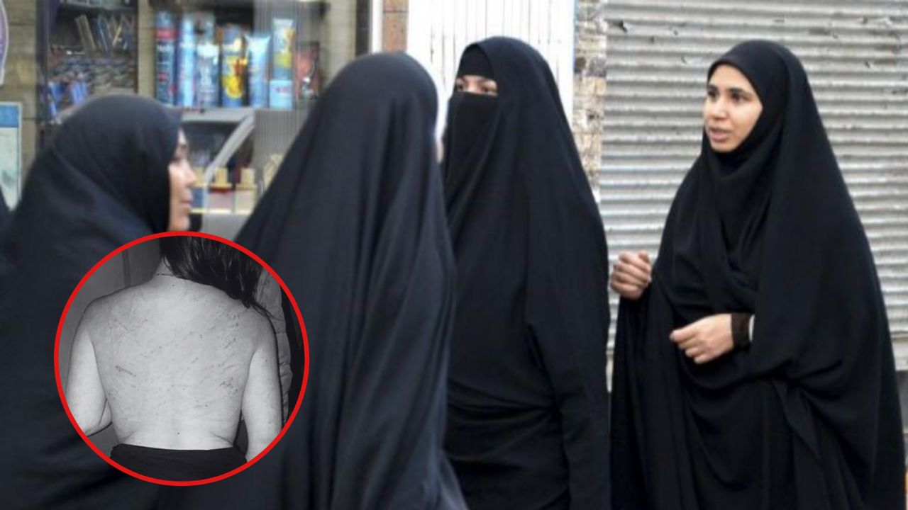 Mujer Recibió 74 Latigazos Por Ofender La Moral Pública En Irán Y No Llevar Velo Mujer Recibió 74 Latigazos Por Ofender La Moral Pública En Irán Y No Llevar Velo