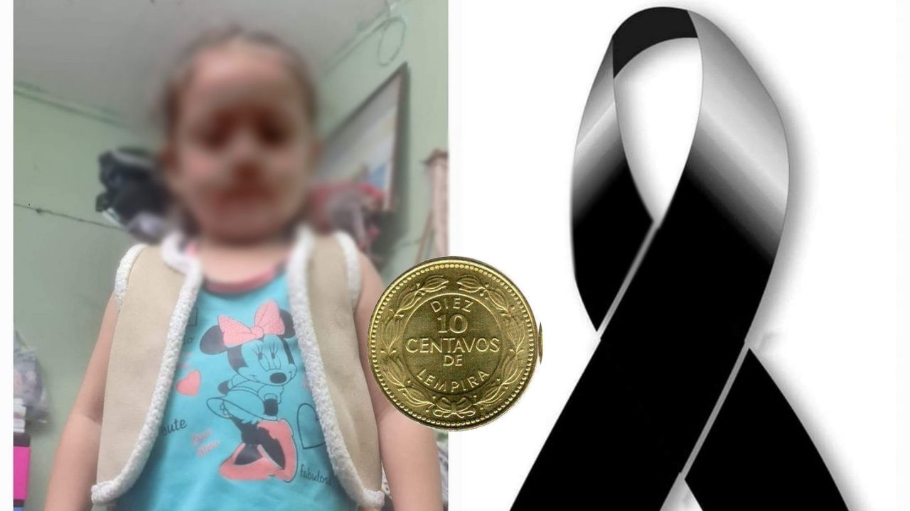Ni a Muere Despu s De Tragarse Una Moneda En Col n ni-a-muere-despu-s-de-tragarse-una-moneda-en-col-n