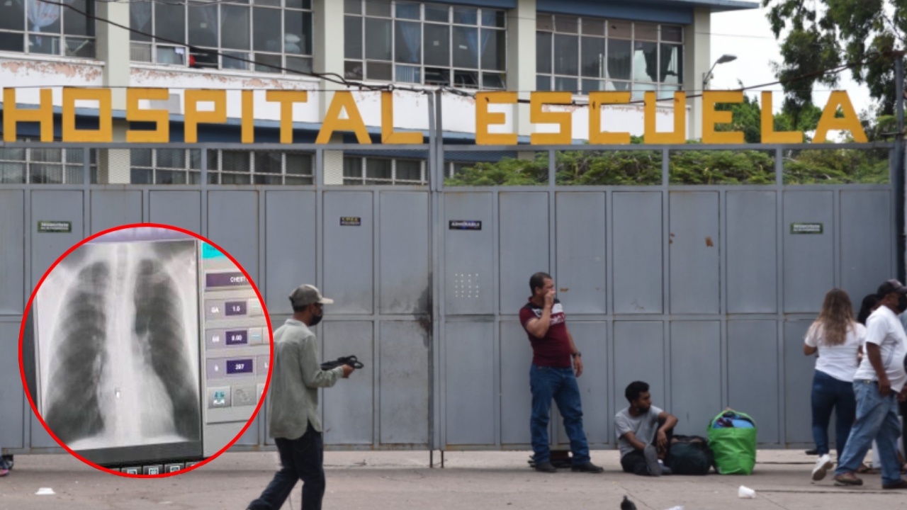 Denuncian falta de material para imprimir radiografías en el Hospital ...