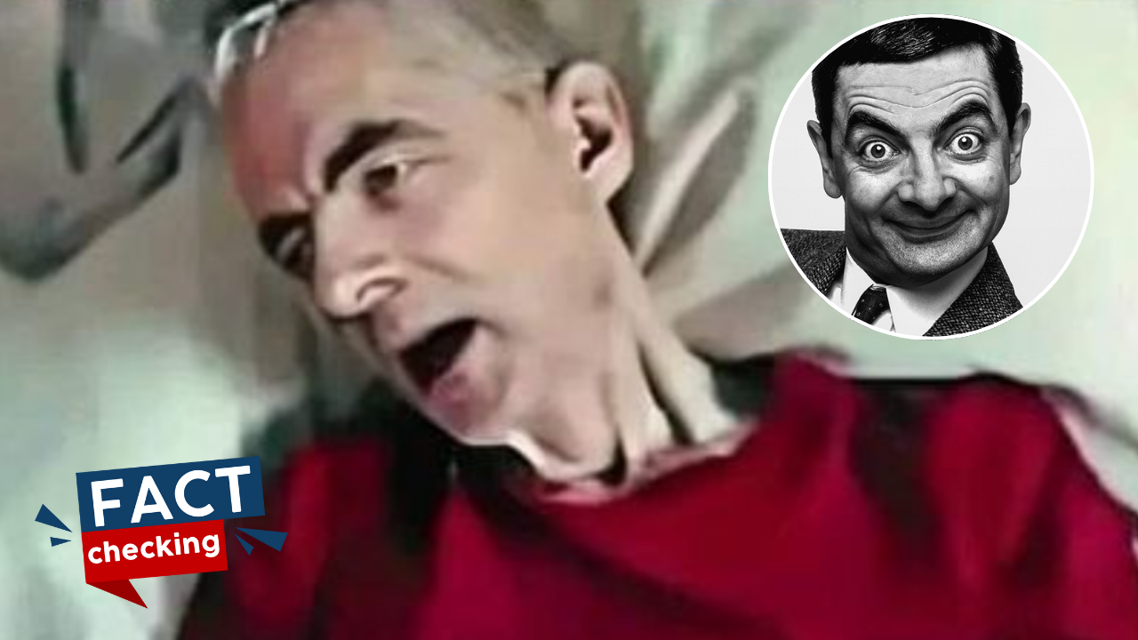 Is it true that Mr. Bean died? What occurred to actor Rowan Atkinson
