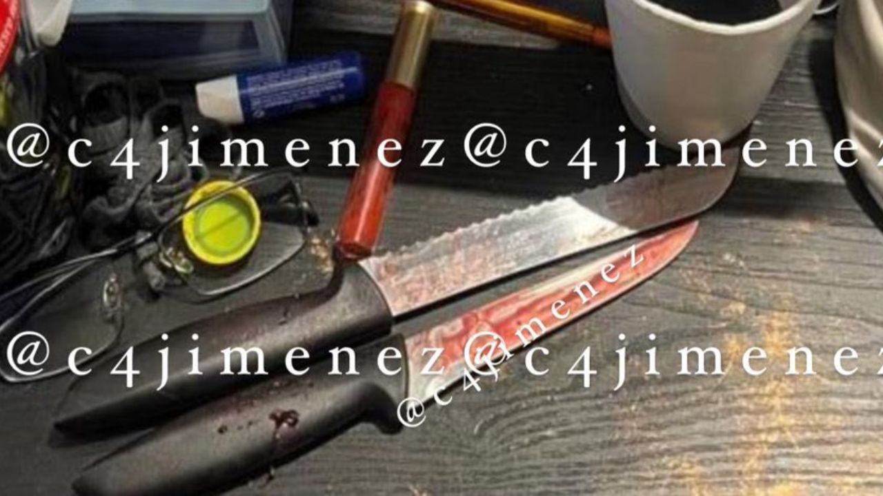 Mano de Valentina Twitter fotos: así quedo la joven tras la agresión de