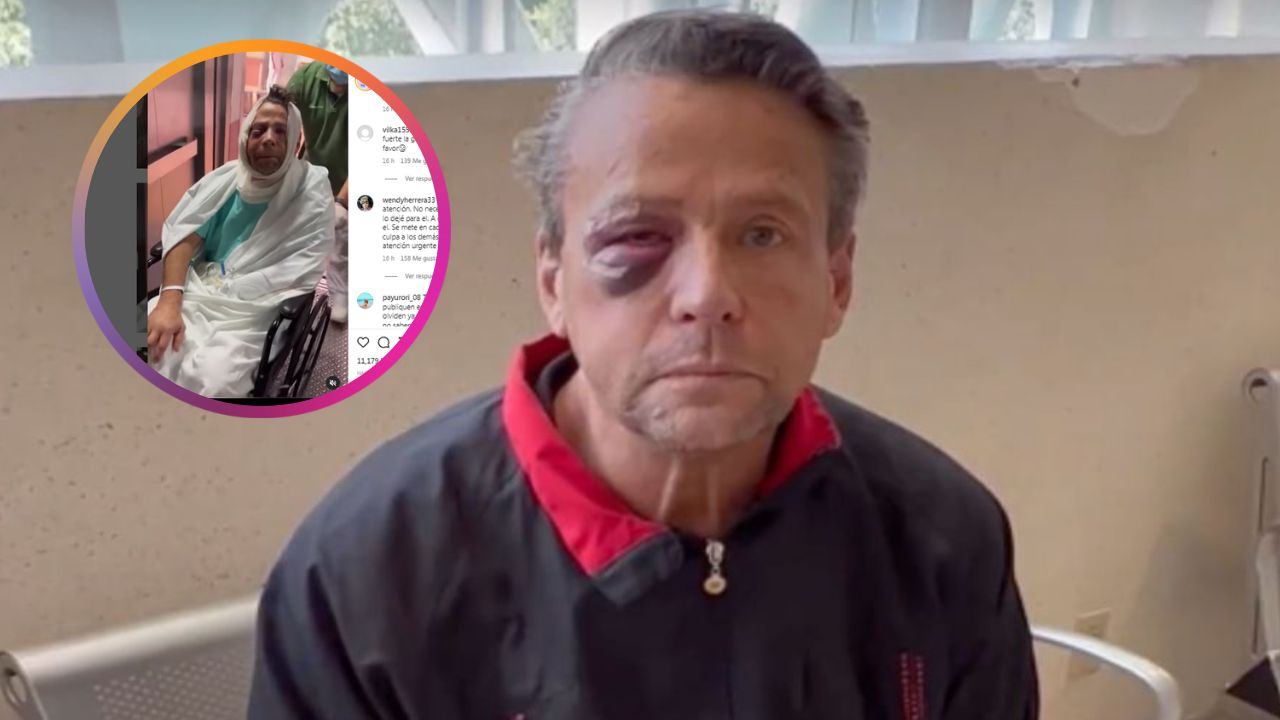 Impactantes imágenes de Alfredo Aldame al salir del hospital tras ser