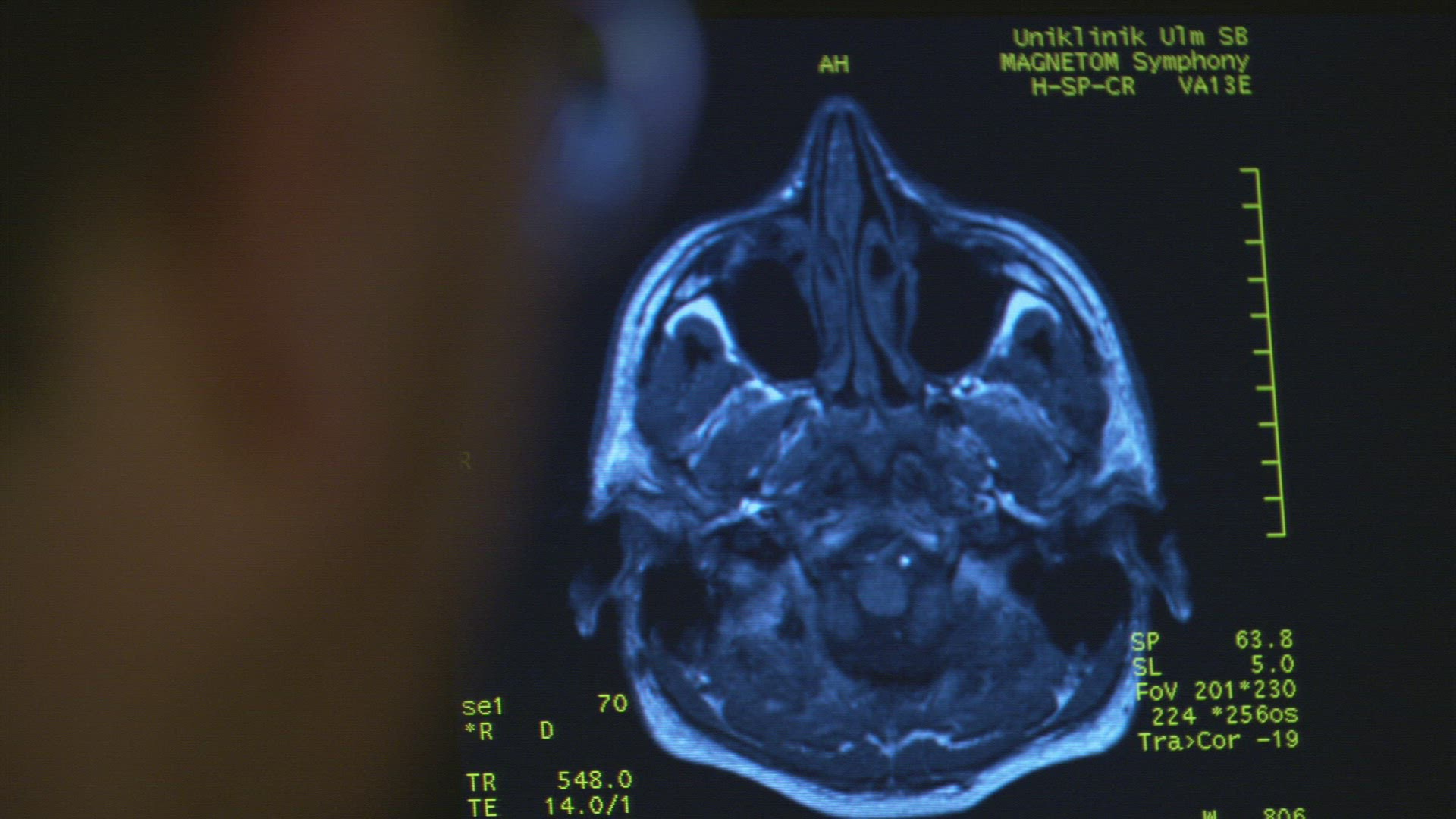 730534956 / People / Magnetic Resonance Imaging / Germany