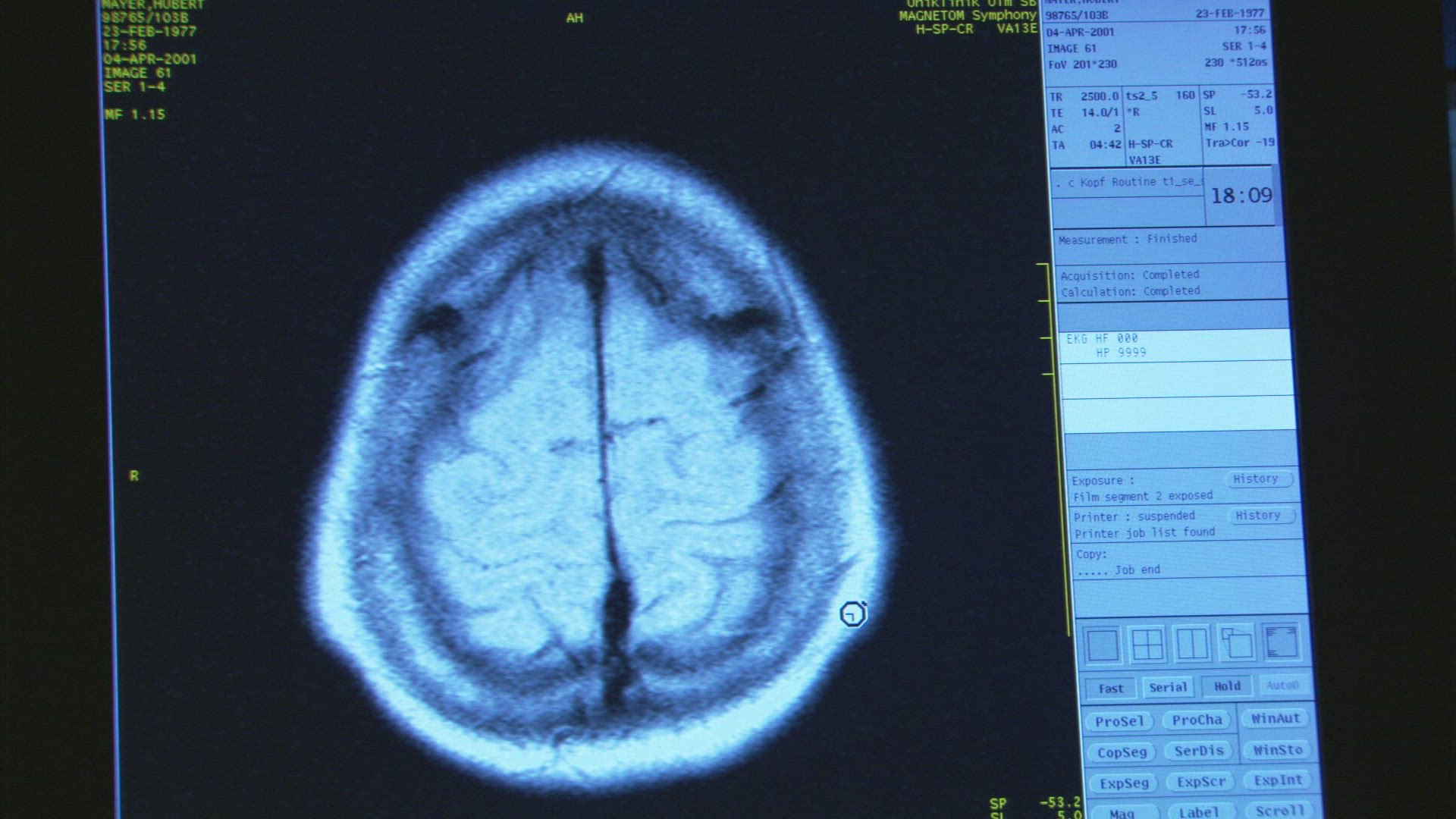 721677439 / People / Magnetic Resonance Imaging / Germany