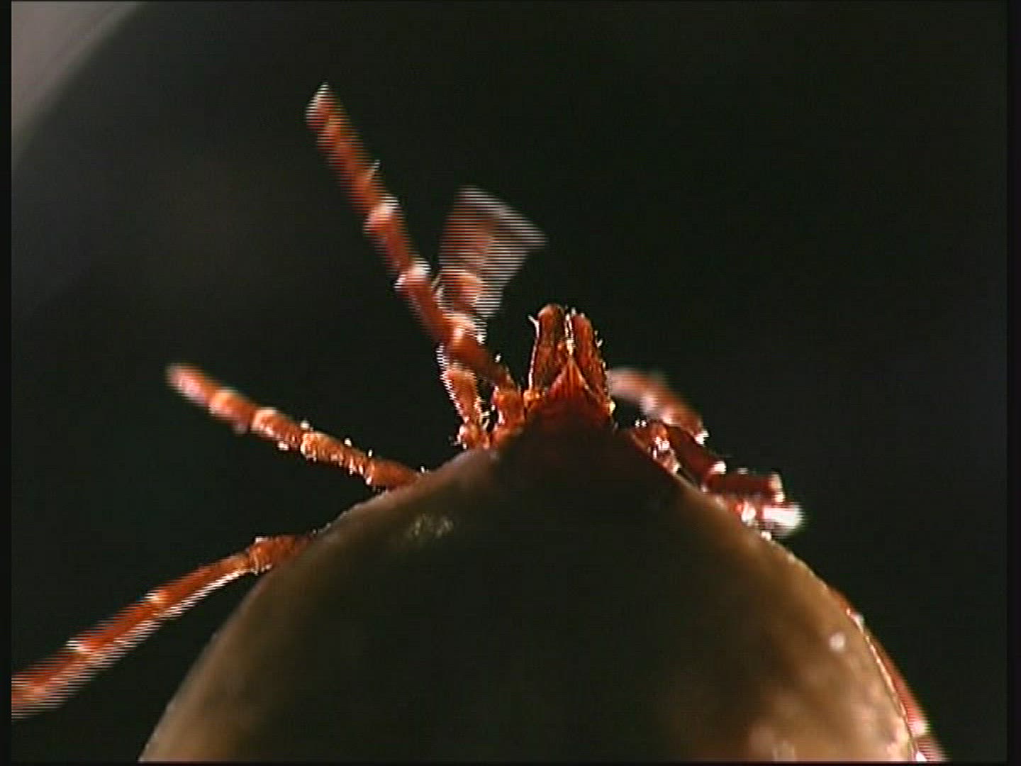 296436424 / Wood Tick / Tick