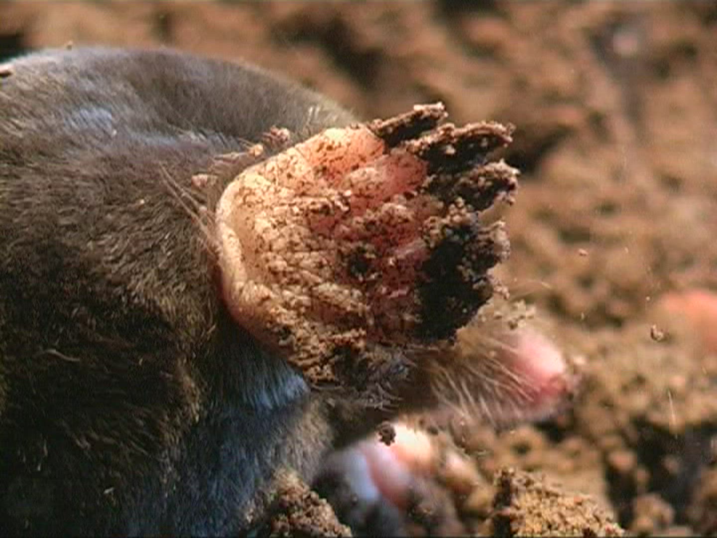 864642048 / Mole / Body Part
