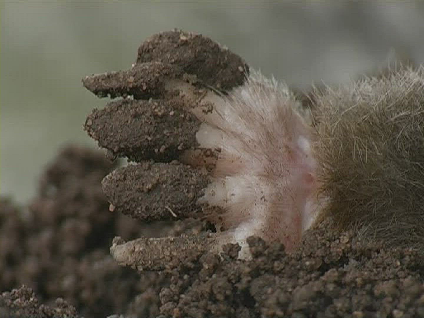 157447810 / Mole / Body Part