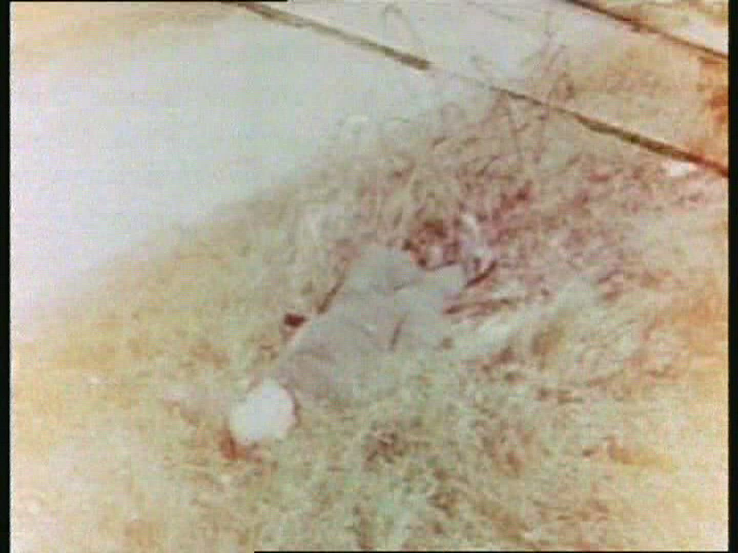 760145536 / Injured Person / German Soldier / Czech Republic / 1945