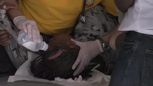 Doctors work in a trauma center to treat a serious head wound following the Haiti earthquake.