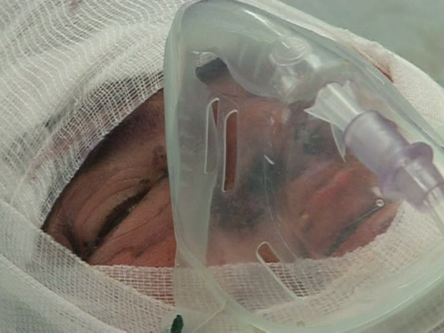 902372831 / Woman / Self-immolation / Afghanistan