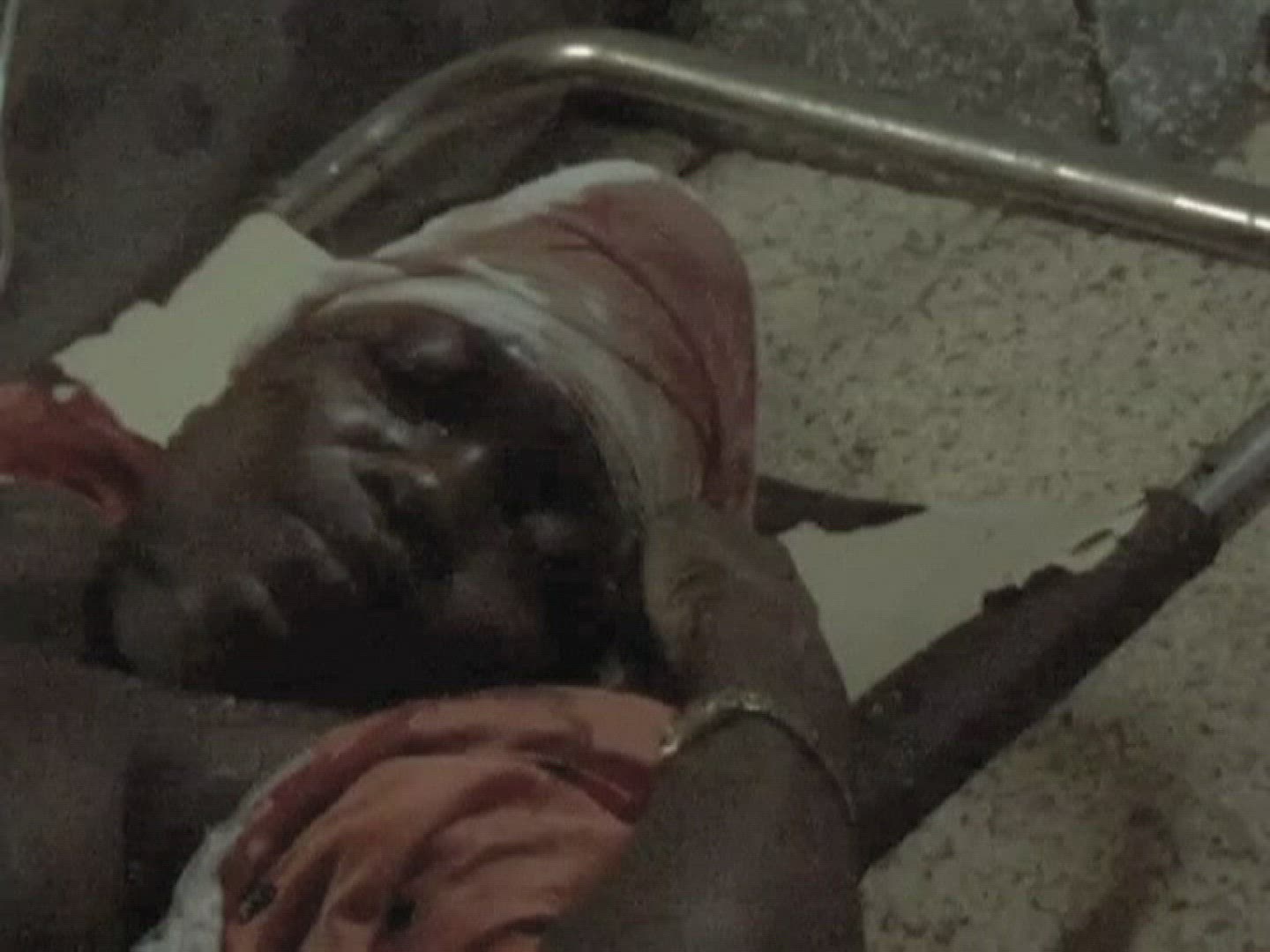 441130183 / Bomb Attack / Victim / Uganda / 2010